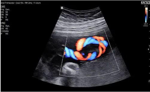 Échographie HERA W10 Elite – Image 8