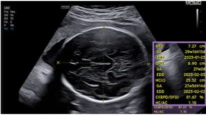 Échographie HERA W10 Elite – Image 10