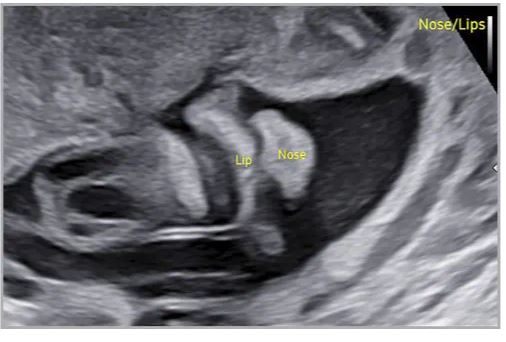 Échographie HERA W10 Elite – Image 9