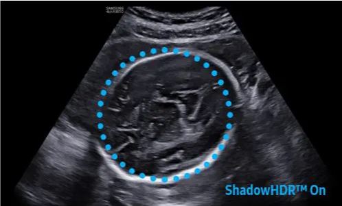 Échographie HERA W10 Elite – Image 17