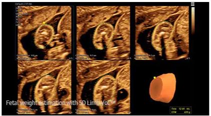 Échographie HERA W10 Elite – Image 12