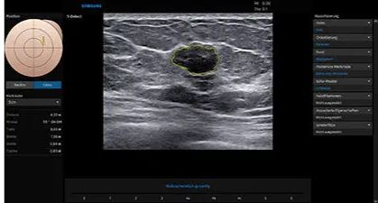 Échographie HERA W10 Elite – Image 13