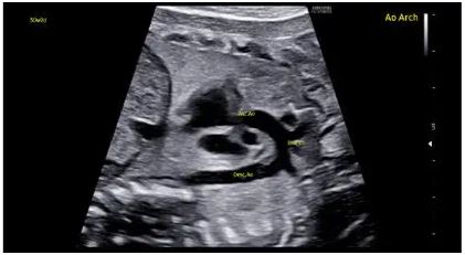 Échographie HERA W10 Elite – Image 14