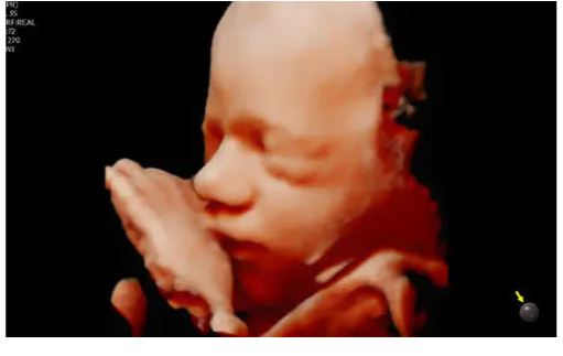 Échographie HERA W10 Elite – Image 6