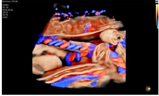 Échographie HERA W10 Elite – Image 5