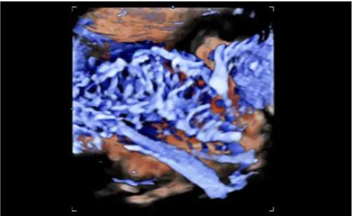 Échographie HERA W10 Elite – Image 4