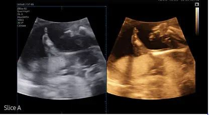 Échographie HERA W10 Elite – Image 15