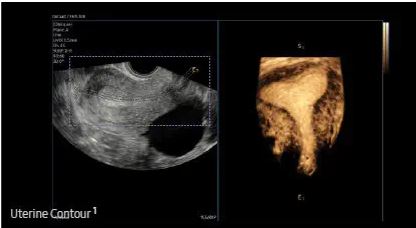 Échographie HERA W10 Elite – Image 7