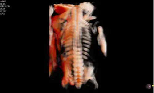 Échographie HERA W10 Elite – Image 16