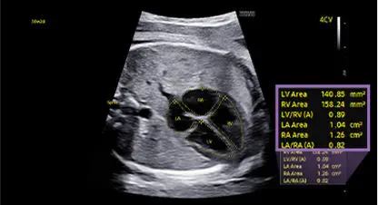 Échographie HERA W10 Elite – Image 3