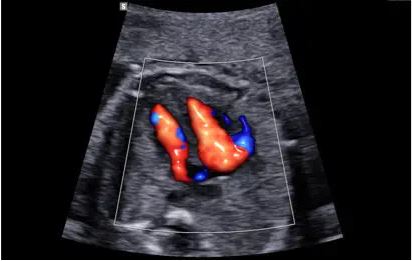 Échographe sur plateforme HERA W10 – Image 3