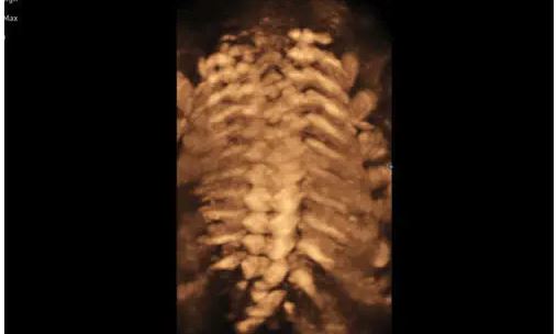 Échographe sur plateforme HERA W10 – Image 4