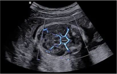 Échographe sur plateforme HERA W10 – Image 5