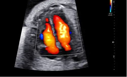 Échographe sur plateforme HERA W10 – Image 6