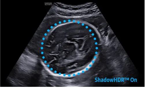 Échographe sur plateforme HERA W10 – Image 8