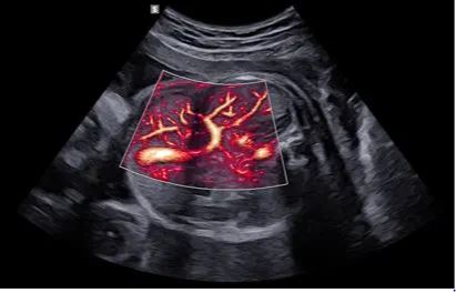 Échographe sur plateforme HERA W10 – Image 10