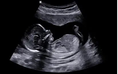 Échographe sur plateforme HERA W10 – Image 11