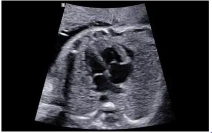 Échographe sur plateforme HERA W10 – Image 12