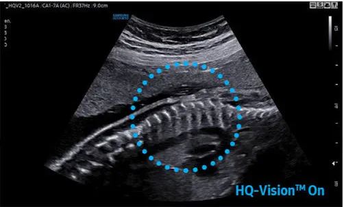 Échographe sur plateforme HERA W10 – Image 13