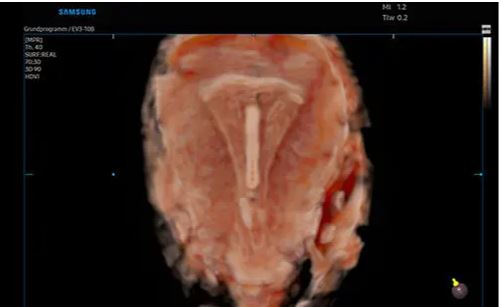 Échographe sur plateforme HERA W10 – Image 14