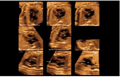 Échographe sur plateforme HERA W10 – Image 17