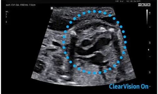 Échographe sur plateforme HERA W10 – Image 18