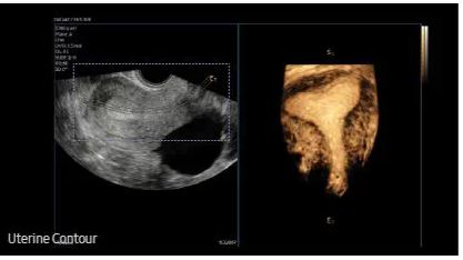 Échographe sur plateforme HERA W10 – Image 20