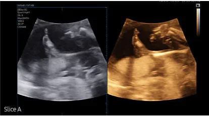 Échographe sur plateforme HERA W10 – Image 21