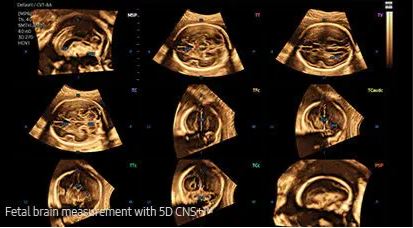 Échographe sur plateforme HERA W10 – Image 22