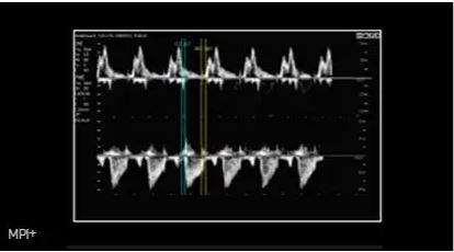 Échographe sur plateforme HERA W10 – Image 24