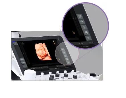 Échographe sur plateforme HERA W10 – Image 25