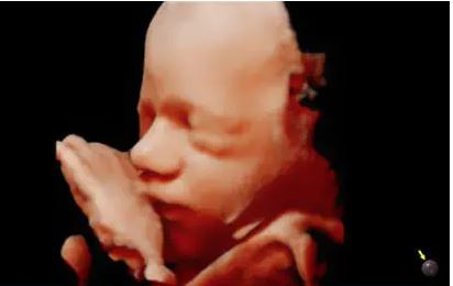 Échographe sur plateforme HERA W9 – Image 4