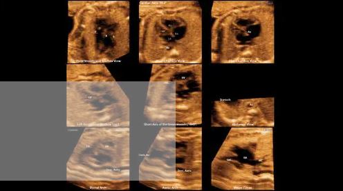 Échographe sur plateforme HERA W9 – Image 7