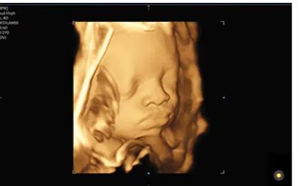 Échographe sur plateforme HERA W9 – Image 8