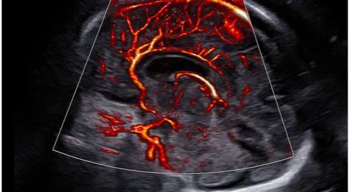 Échographe sur plateforme HERA W9 – Image 11