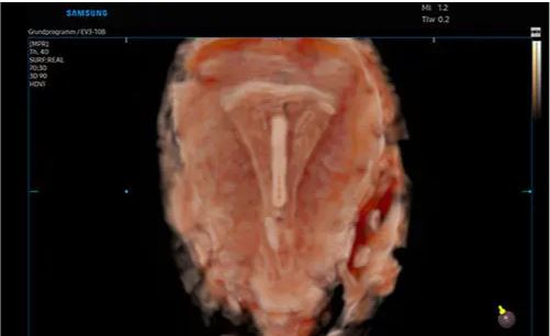 Échographe sur plateforme HERA W9 – Image 13