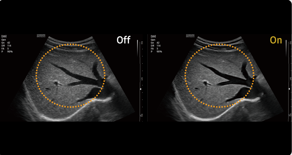 HM70 EVO – Échographe Portable – Image 2