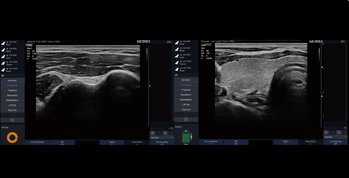 HM70 EVO – Échographe Portable – Image 3