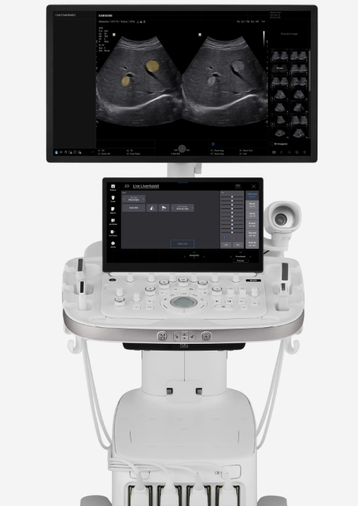 Échographe Samsung R20
