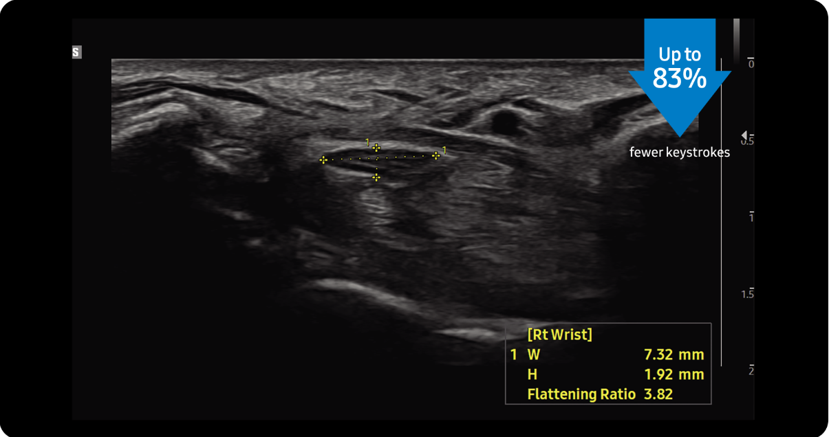 Appareil Échographie Samsung V4 – Image 2