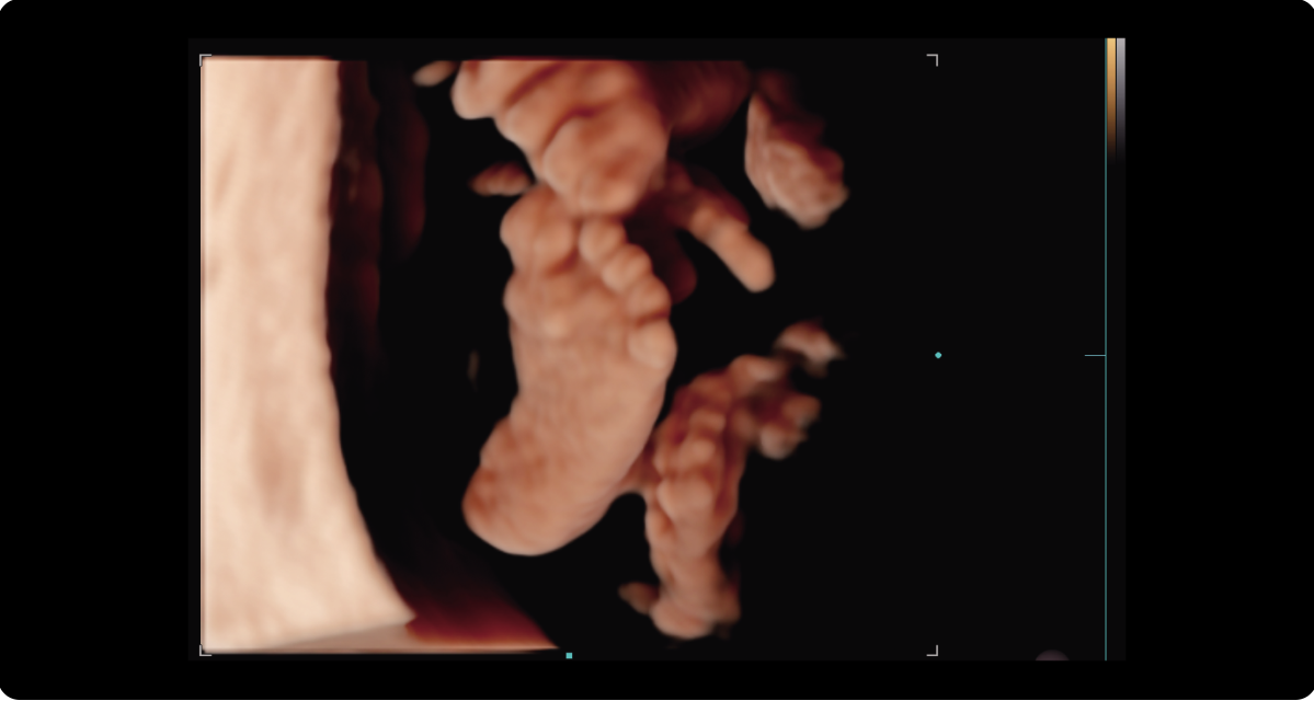 Appareil Échographie Samsung V4 – Image 3