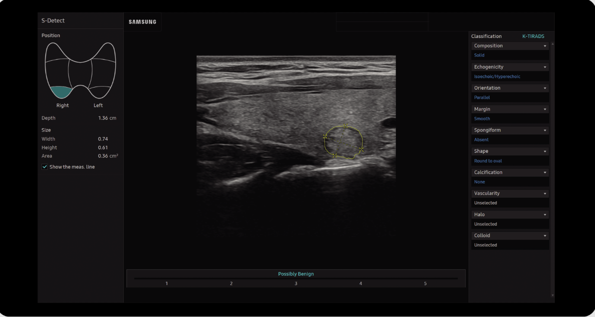 Appareil Échographie Samsung V4 – Image 4