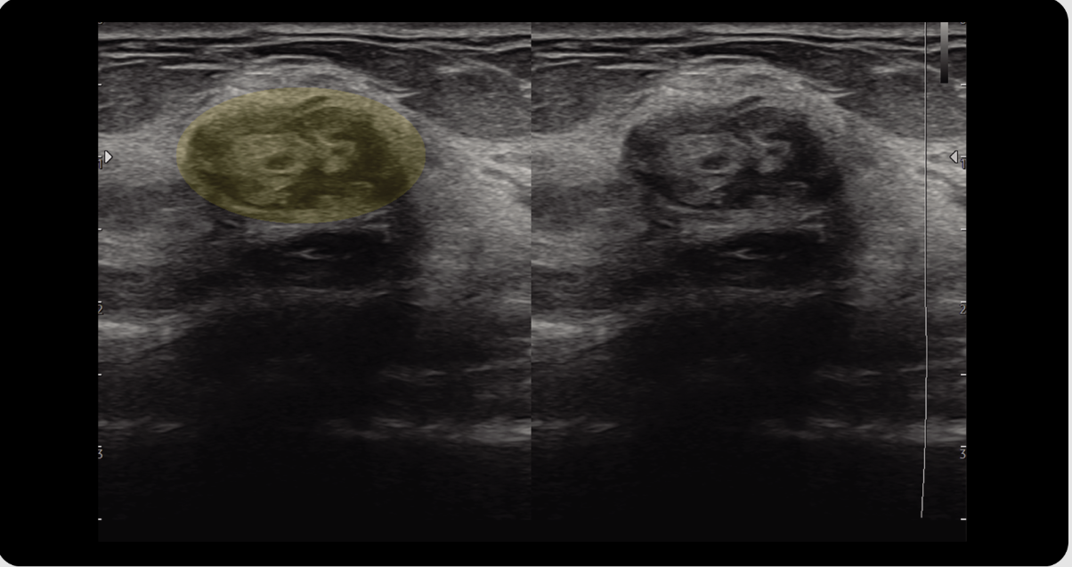 Appareil Échographie Samsung V4 – Image 5