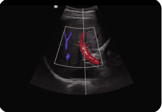 Appareil Échographie Samsung V4 – Image 6