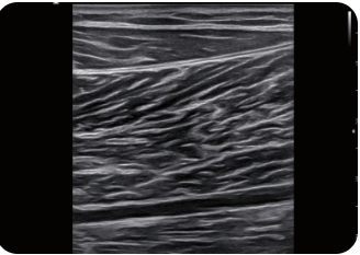 Appareil Échographie Samsung V4 – Image 7