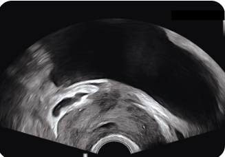 Appareil Échographie Samsung V4 – Image 9